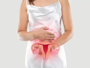 علائم کیست شکلاتی